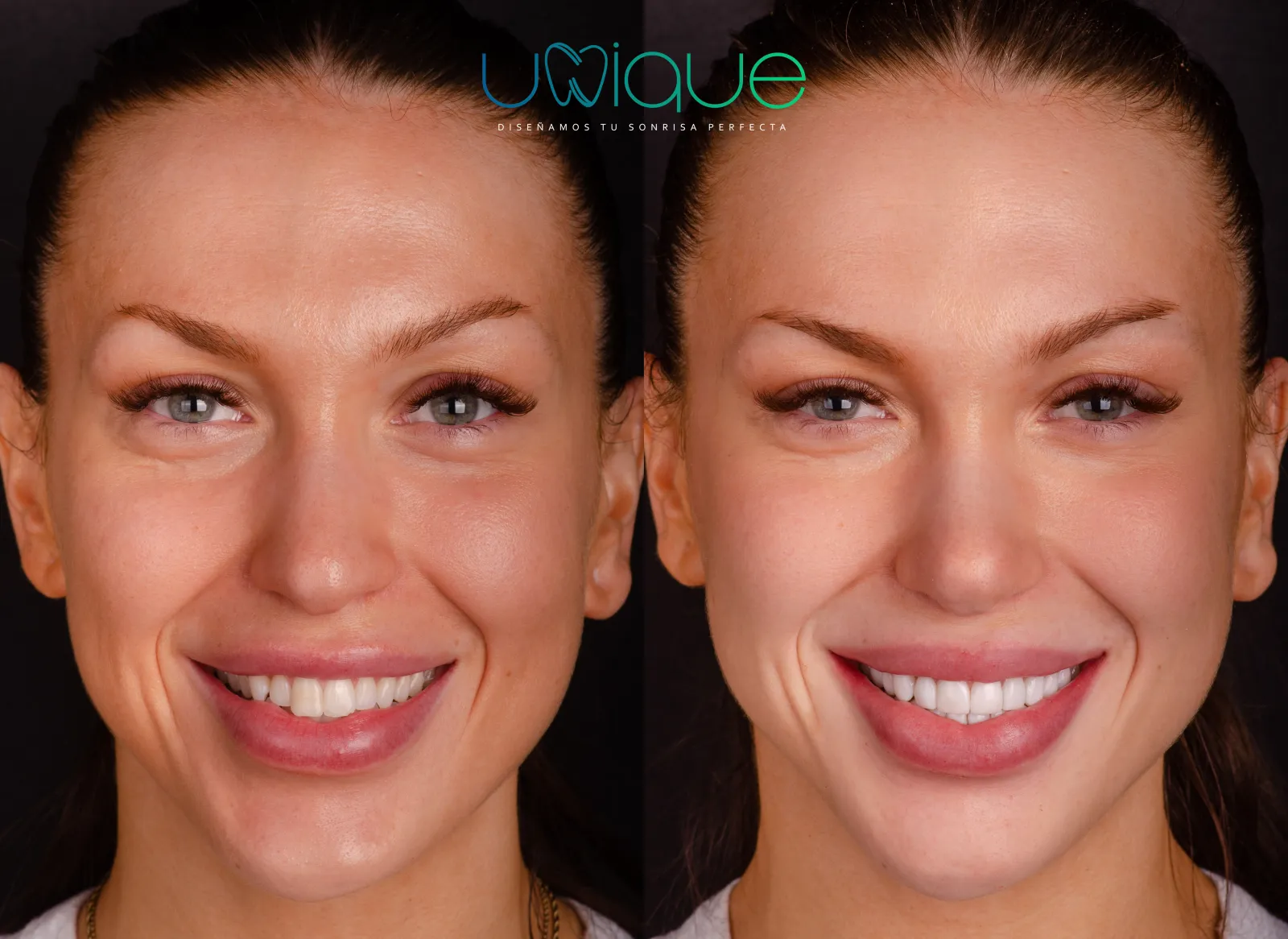 Resultado dental antes y después 3